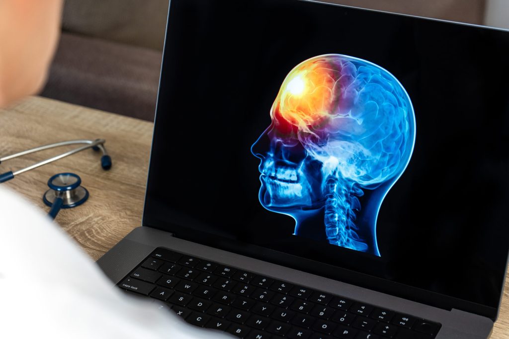 Traumatic Brain Injury Lawyer in Boston, MA